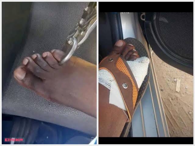 CITIZENS OF ZIMBABWE STARTING TO CUT AND SELL THEIR TOES AS A RESULT HIGH COST OF LIVING AND HIGH UNEMPLOYMENT RATES, CITIZENS OF ZIMBABWE STARTING TO CUT AND SELL THEIR TOES AS A RESULT HIGH COST OF LIVING AND HIGH UNEMPLOYMENT RATES, INFINITY LOADED