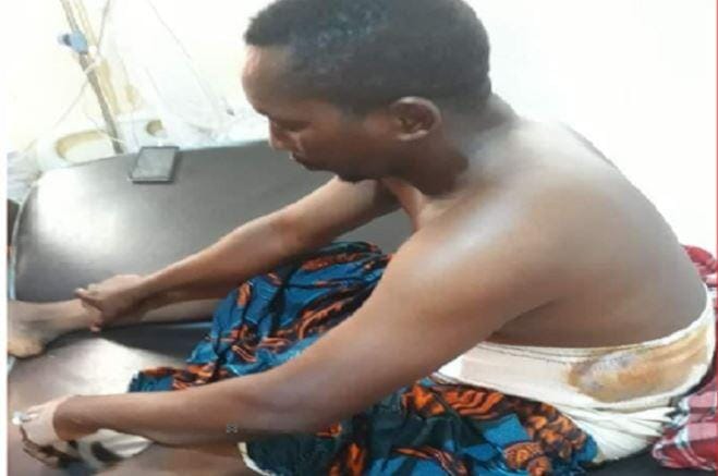 Man narrates How he Escaped Killer Herdsmen Who Ripped his Intestines With Bullets, Man narrates How he Escaped Killer Herdsmen Who Ripped his Intestines With Bullets, INFINITY LOADED