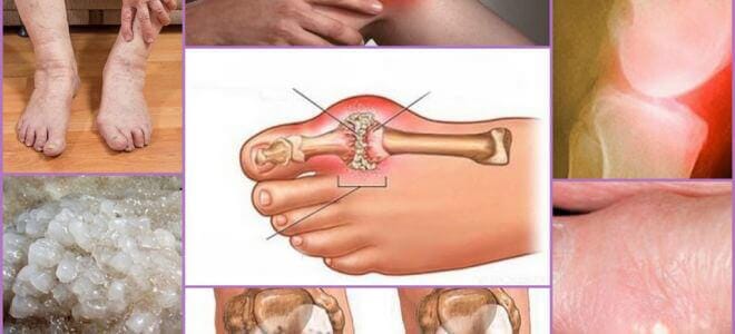 Arthrazex balm: The way Nigeria treats joints is just bewildering&rdquo;. Prominent Indian rheumatologist gives candid interview to Nigerian newspaper, Arthrazex balm: The way Nigeria treats joints is just bewildering&rdquo;. Prominent Indian rheumatologist gives candid interview to Nigerian newspaper, INFINITY LOADED